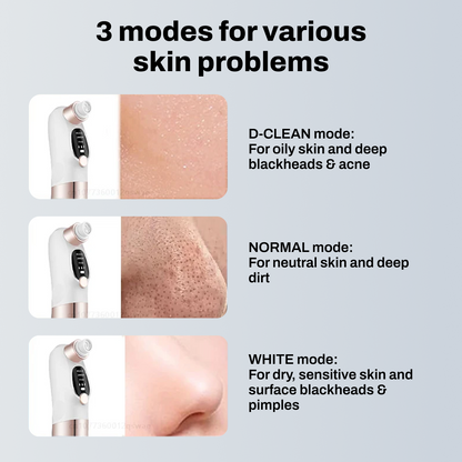 Pore Perfect Vacuum Cleaner